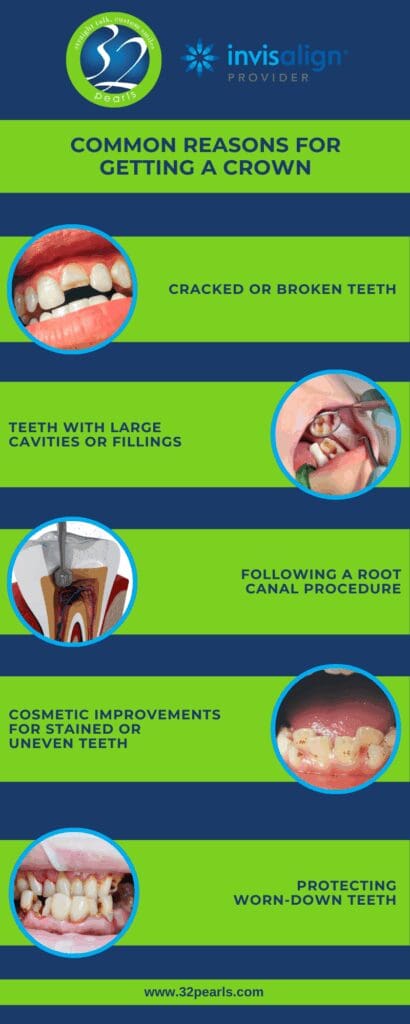 Common Reasons for Getting a Crown